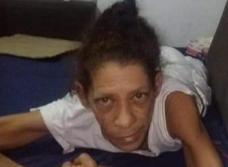 Bordadeira que teve as pernas amputadas e foi abandonada pelo marido pede ajuda para comprar cadeira de rodas