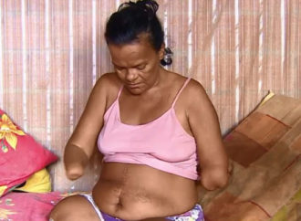 Mulher sem mãos e pernas tem pedido de benefício negado pelo INSS