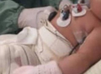 Morre bebê que teve corpo queimado em hospital; enfermeira responderá por homicídio
