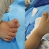 Médico abre mão de pagamento e opera bebê sem cobrar honorários