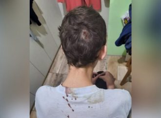 COM FOTOS: adolescente autista espancado pelo pai em Canoas tem diversas lesões pelo corpo