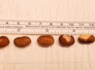 Médicos retiram seis grãos de feijão do canal da uretra de paciente