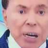 Entenda o que aconteceu com os dentes de Silvio Santos