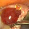 CURIOSIDADE: foto que mostra o exato momento em que um ovário libera um óvulo.