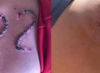 Adolescente usa ferro em brasa para marcar número de Bolsonaro