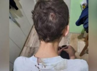 Mãe e avó são presas após agredirem garoto autista em Canoas