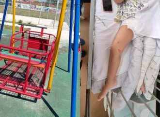Criança autista tem perna fraturada ao brincar em playground e mãe faz alerta